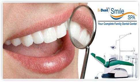Smile Spa Banjara Hills - Pay Rs 239 to get dental consultation & services worth Rs 1050 at Smile Spa.