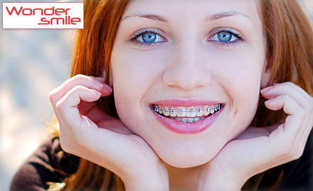 Wonder Smile Clinic Chinchwadgaon - Get 50% off on any braces treatment at Wonder Smile Orthodontic And Multispeciality Dental Clinic.