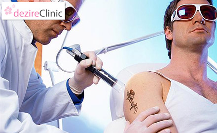 Dezire Cosmetic & Hair Transplant Clinic Erandwane - Get Rid of Those Unwanted Colours! Pay Rs. 499 for Tattoo Removal