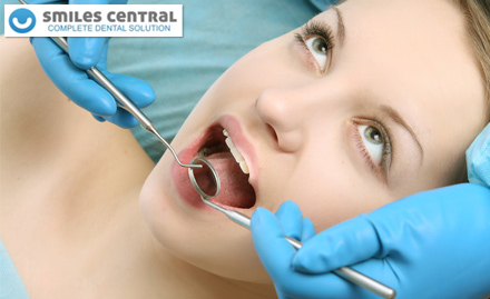 Smiles Central Ashok Nagar - Rs. 29 for 50% off on Dental Services. Get a Reason to Smile!