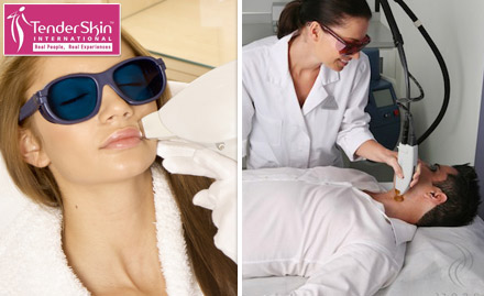 Tender Skin International Malad East - Rs 499 for 1 session of laser hair-reduction treatment. Get smooth skin!