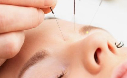 Pain Solution & Acupuncture Research Centre LDA Colony - 50% off on acupuncture treatment. Get rid of all the chronic body aches!