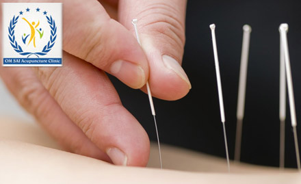 Om Sai Accupuncture Clinic Cholambedu - Get upto 40% off on acupunture treatment & acu products