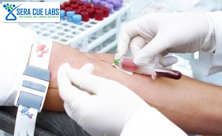 Sera Cue Labs Industrial Area Phase 1 - Get comprehensive health check-up for Rs 919. Get a complete health assessment!