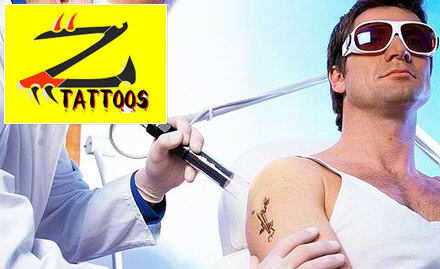 ZEE Body Graphics Tattooz Phase 5 - 30% off on tattoo removal. Make way for new tattoos!