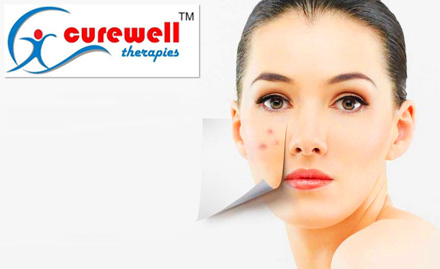 Curewell Therapies Sultanpur - Upto 84% off on skin treatments. Get De-tan facial, Ozone treatment, Microdermabrasion & more!