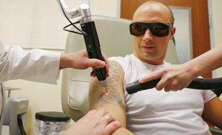 Dr Talwar's Skin Hair And Laser Clinic Sector 34 - 30% off on tattoo removal treatment!