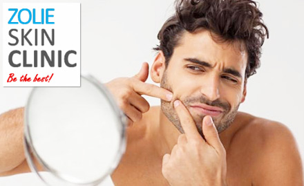 Zolie Skin Clinic Greater Kailash Part 1 - Get 50% off on chemical peeling, acne therapy & more!