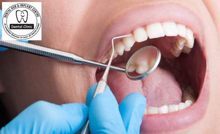 The Dental Hub and Implant Centre Vasant Kunj - Pay Rs 350 for complete dental package!